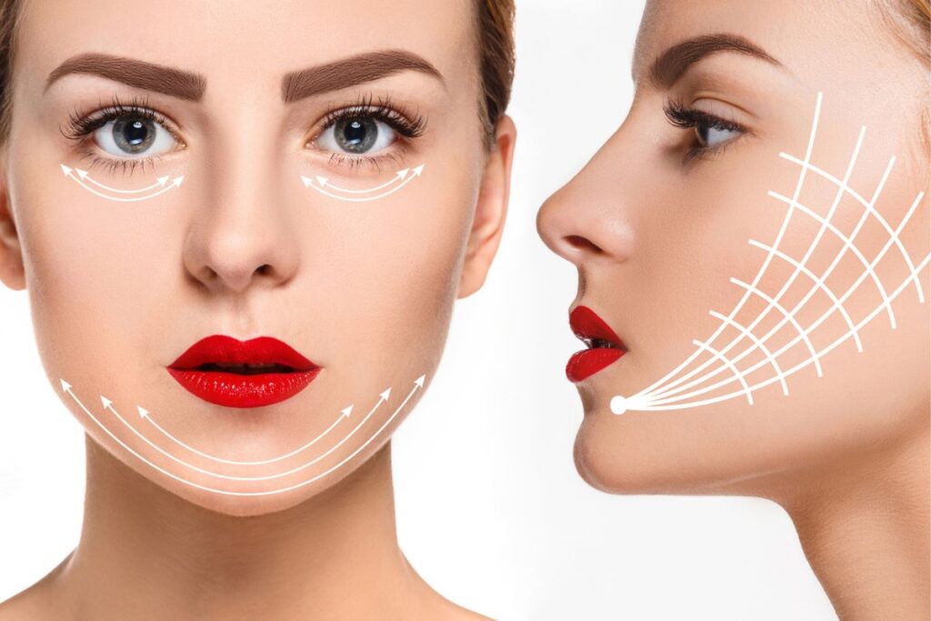 ร้อยไหมก้างปลา