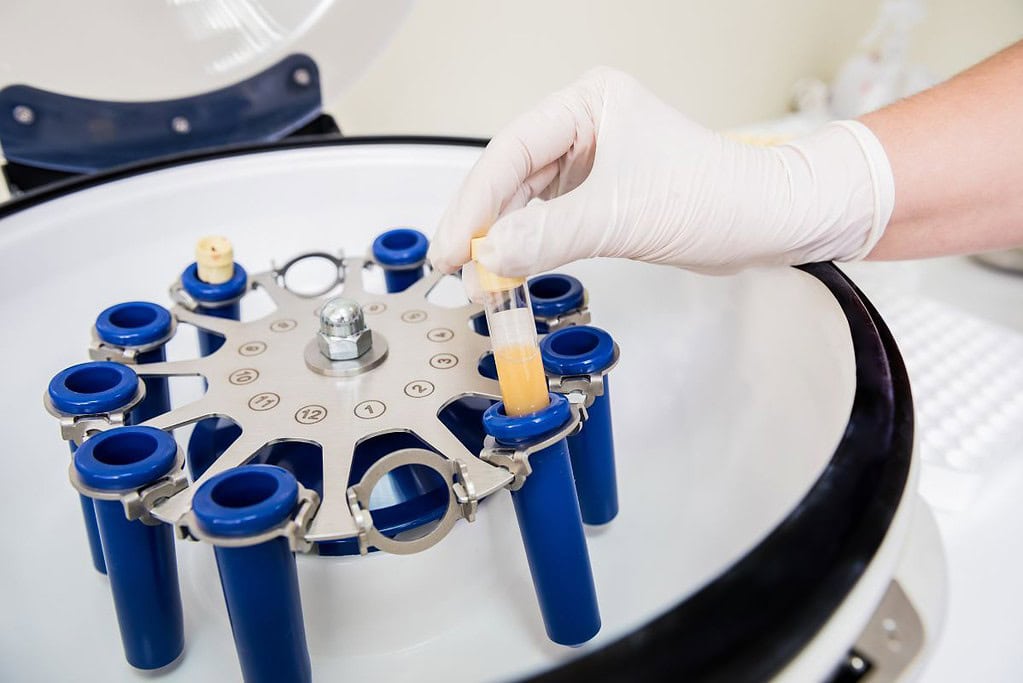 PRP คืออะไร