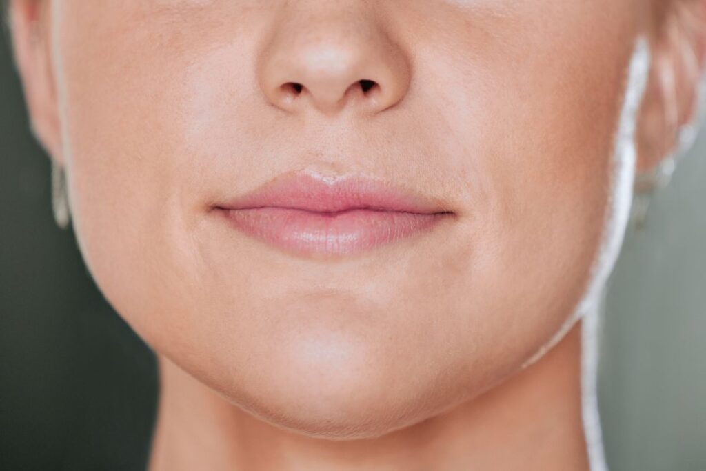 ฟิลเลอร์แก้ม