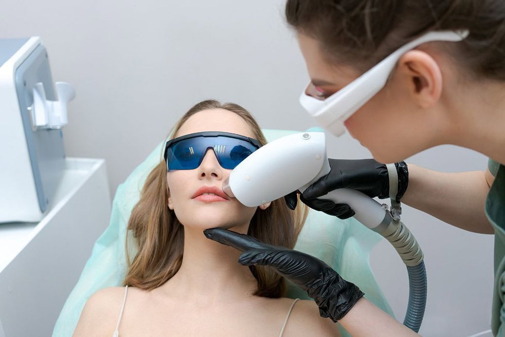 เลเซอร์หนวด