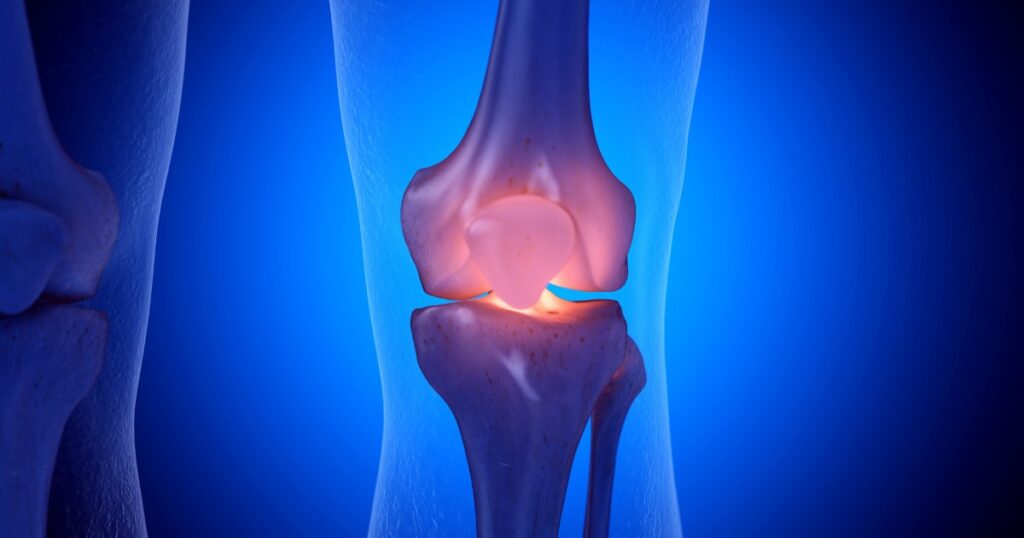 ข้อเข่า