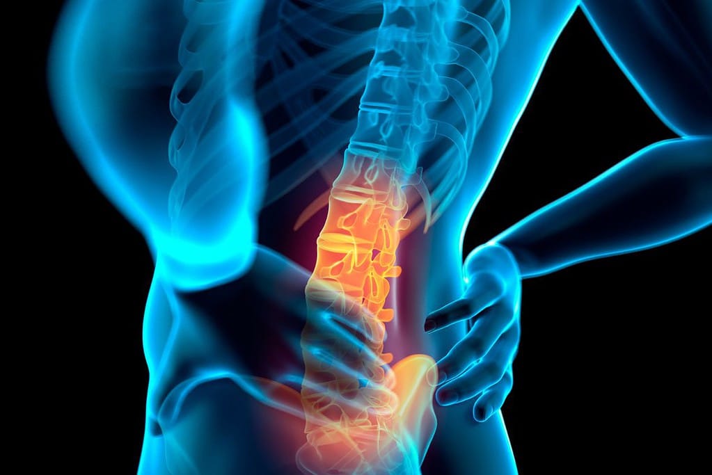 ปวดหลังช่วงเอวผู้หญิง