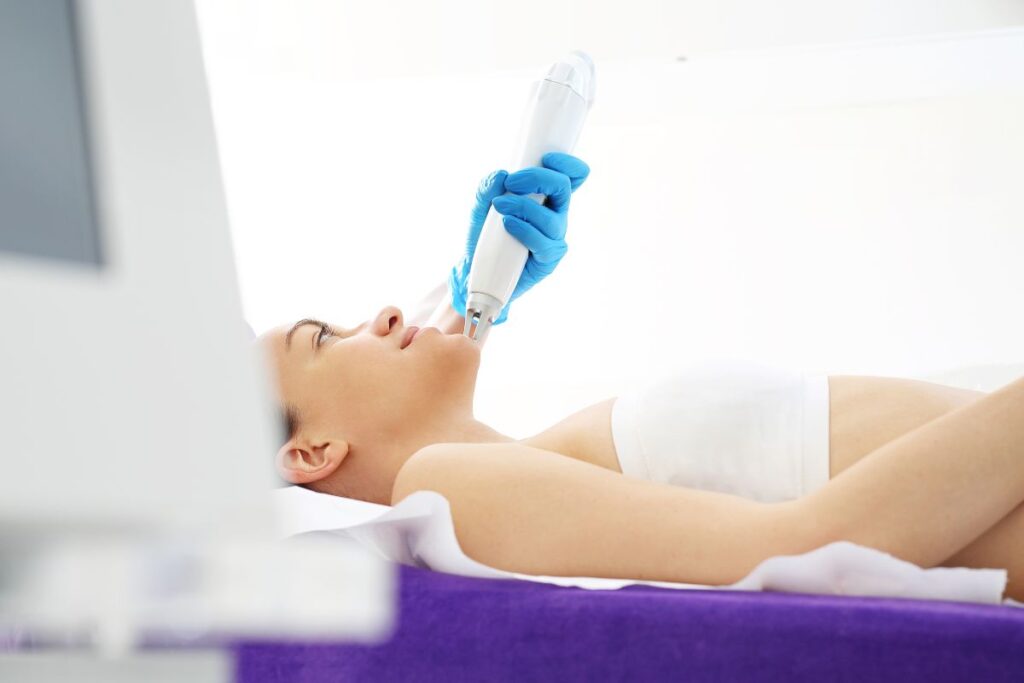 หลุมสิว