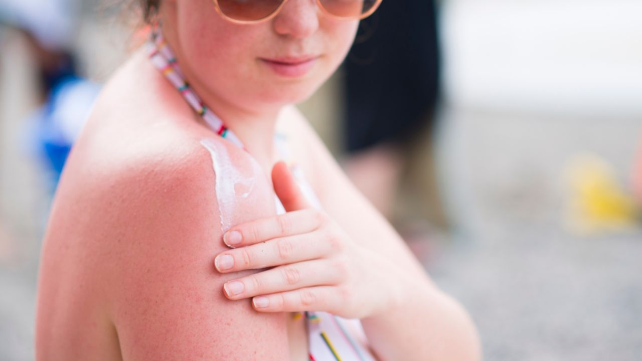 Discover the benefits of after-sun skin recovery, including hydration, even skin tone, and collagen stimulation. Learn how key ingredients like collagen, vitamin C, and ALA help rejuvenate your skin after sun exposure.