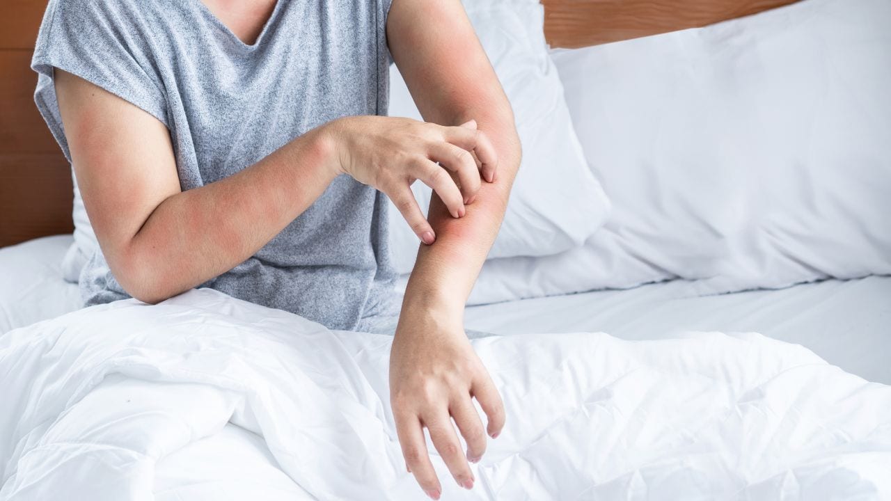 Find out why swimming in the sea after rain can lead to itchy skin. Understand how plankton, marine stingers, and other elements affect your skin and how to protect yourself from irritation.