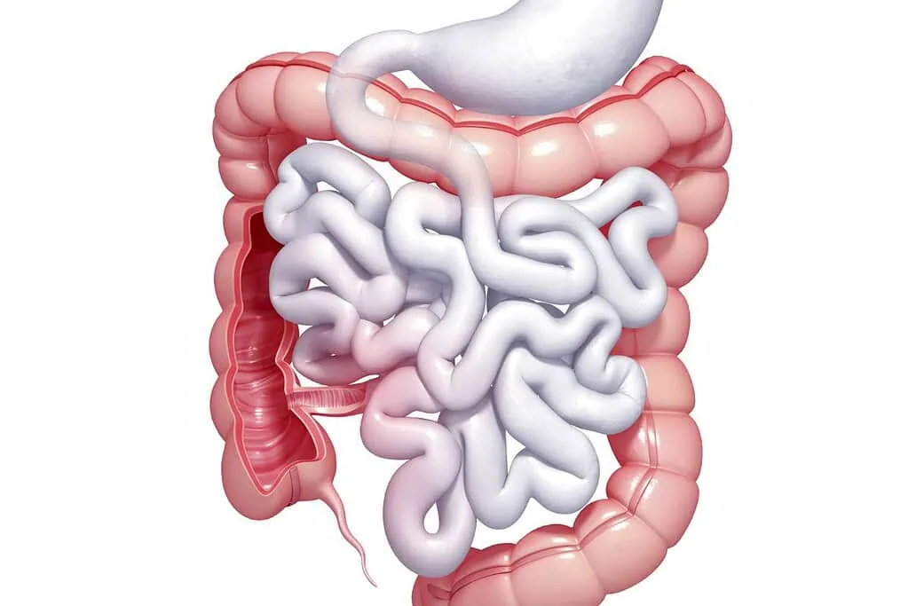 ลำไส้ (Leaky Gut)