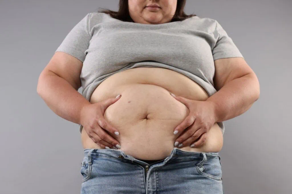 Person holding excess abdominal fat above unbuttoned blue jeans.