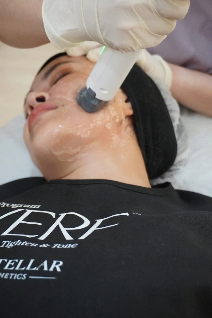 Woman receiving skin tightening facial treatment with handheld device and gel.
