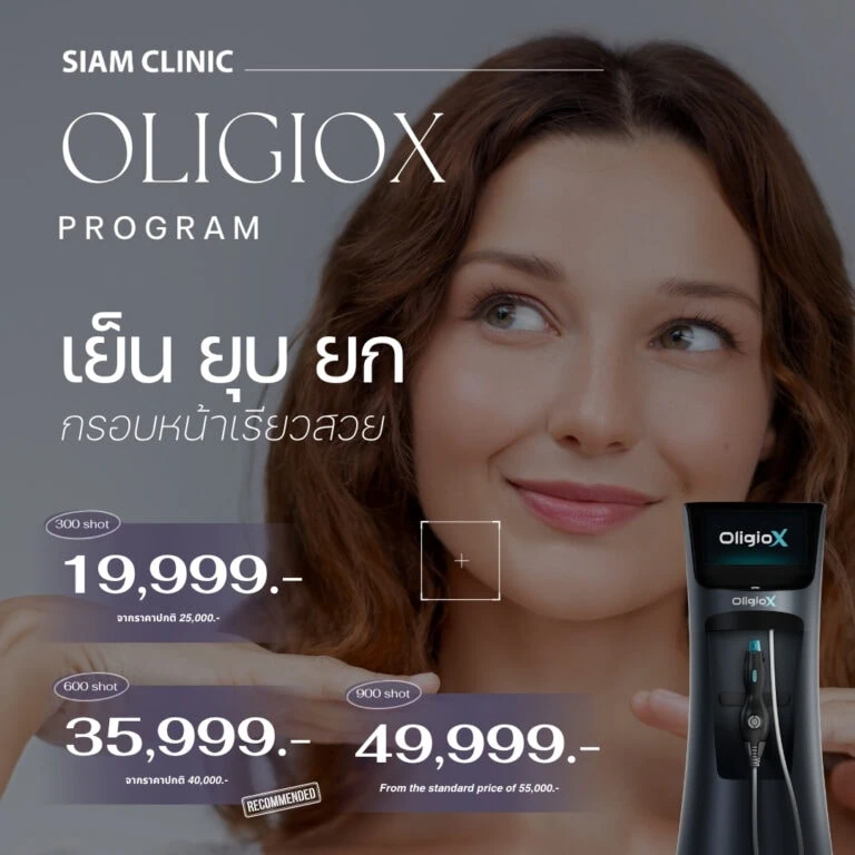 Oligiox facial treatment device held by a smiling woman with clear skin, promotional prices for 300 and 600 shot packages, and Thai text highlighting skin rejuvenation benefits.